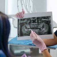 Zubní implantát - řešení